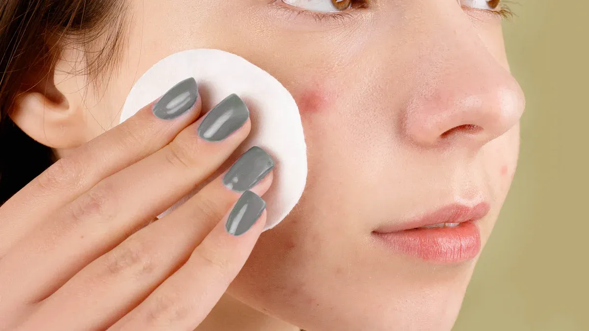 Simple Ways to Prevent Acne Flare-Ups Before Your Period